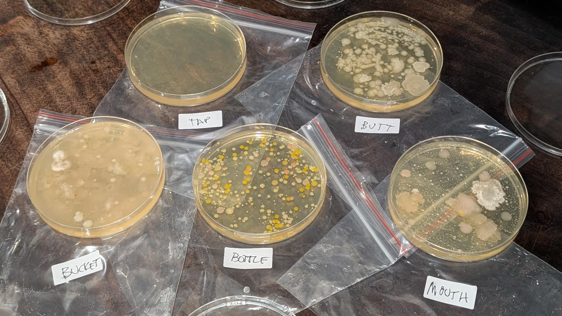 Bacteria Water Test Kit - 12 Tests Detects 50 Different Species of Coliform Bacteria, E.coli & All Bacteria | Home Test Kit for Well, Tap, Pool, Hot Tub & City Water | with Free Lab Analysis customer photo 1