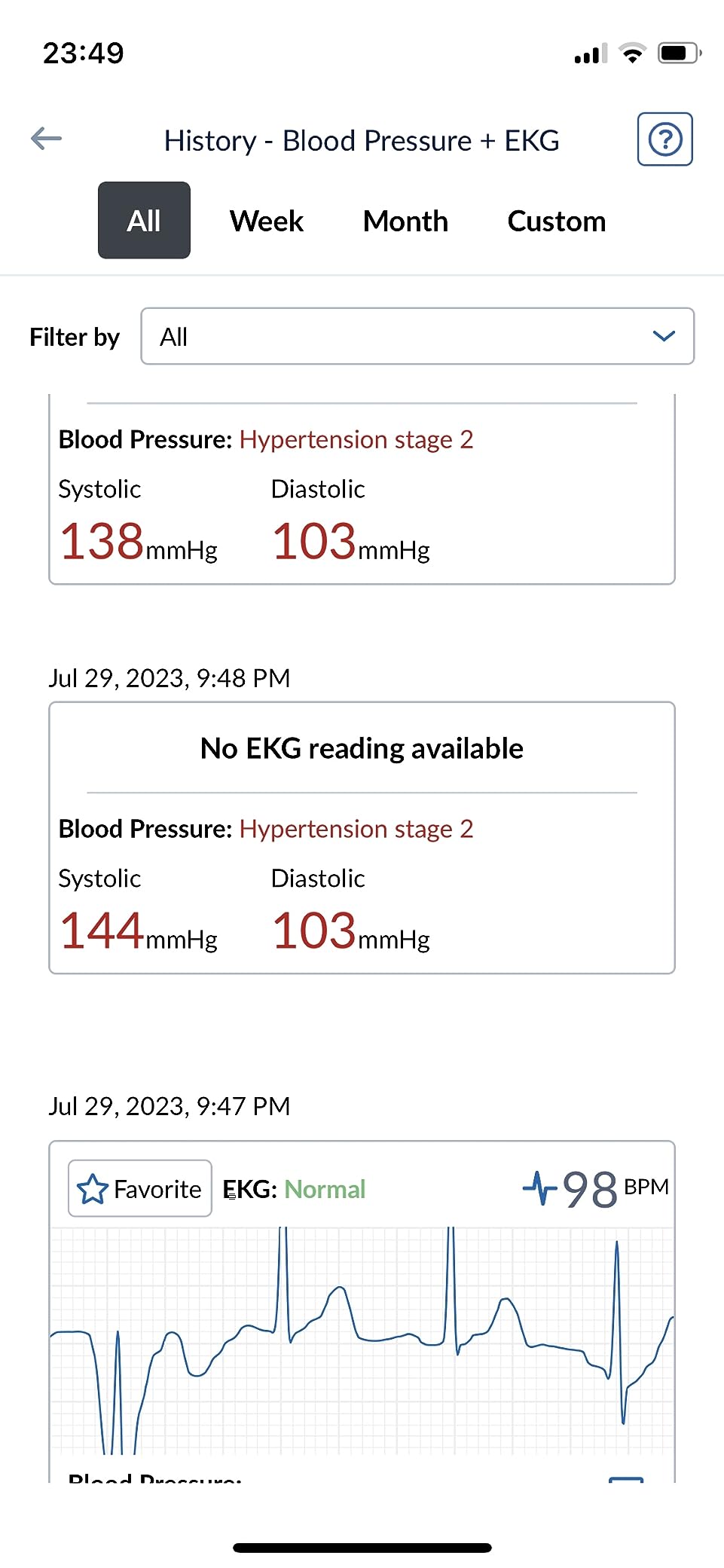 OMRON Complete 2-in-1 Blood Pressure Monitor + EKG for Home Use | Upper Arm Blood Pressure Cuff - #1 Doctor & Pharmacist Recommended Brand - Clinically Validated - Connect App customer photo 1