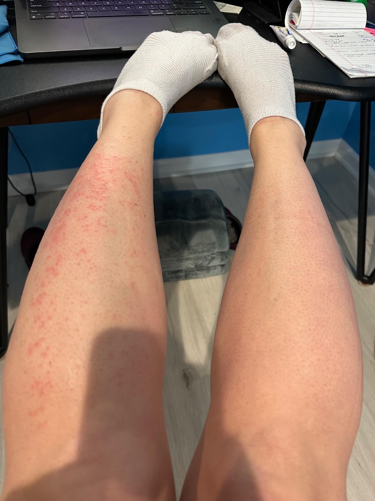 Braun IPL, Silk·Expert Pro 5, IPL Hair Removal for Women and Men, Permanent Laser Hair Reduction At-Home, 2 Heads, Pouch, IPL5137 customer photo 2