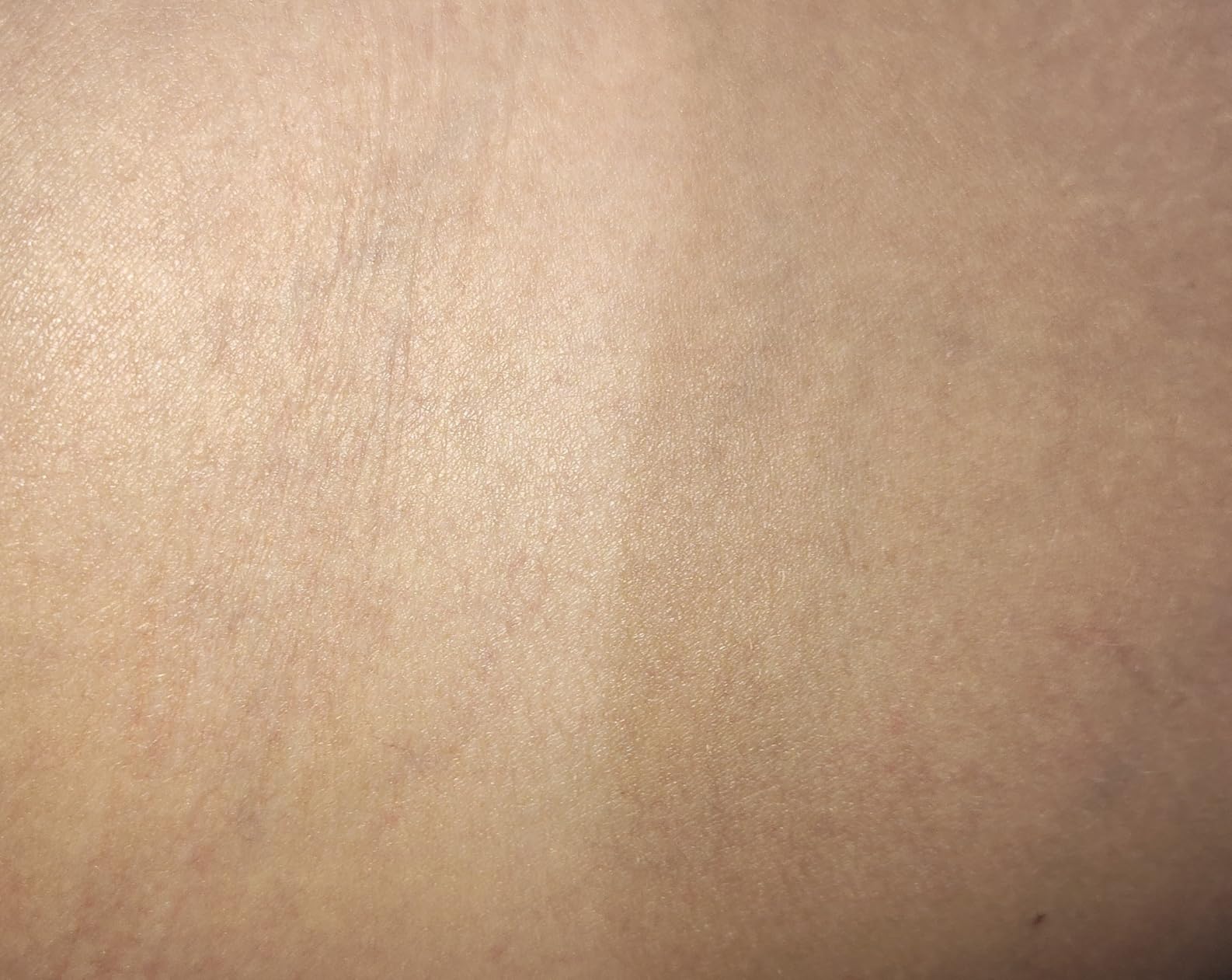 Ulike Laser Hair Removal Device Air 10 IPL for Women and Men, Ice cool and Permanent Hair Reduction for Nearly Painless, Dual Lights, Skin Sensor & USHR Mode customer photo 2