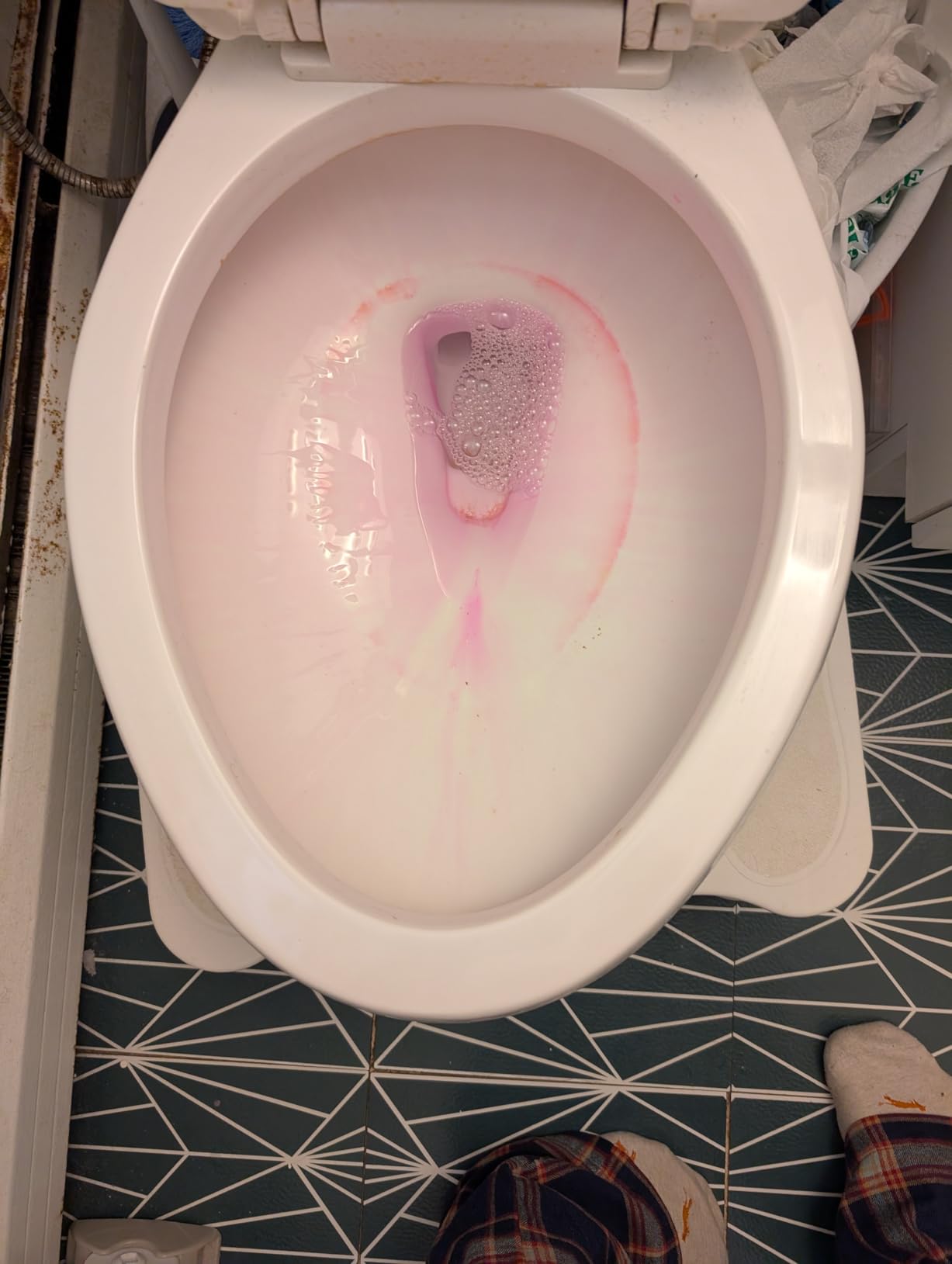 Stardrops The Pink Stuff Miracle Toilet Gel Cleaner, 25 Fl Oz customer photo 1