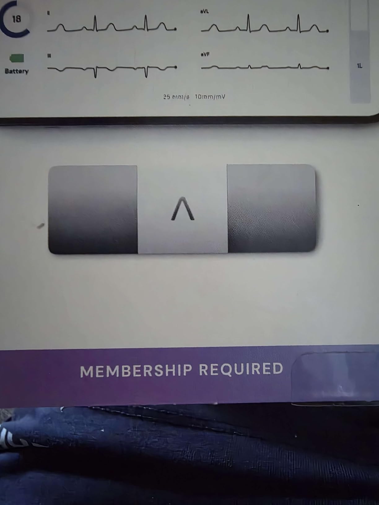 KardiaMobile 6L Max 6-Lead EKG + One-Year Membership, Unlimited Recordings customer photo 1