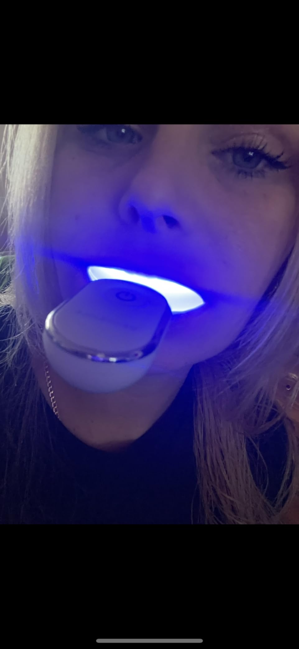 Teeth Whitening Kit with LED - Formulated for Sensitive Teeth, Hands-Free, Waterproof LED Light and 4 Gel Pens, Instant Results customer photo 1