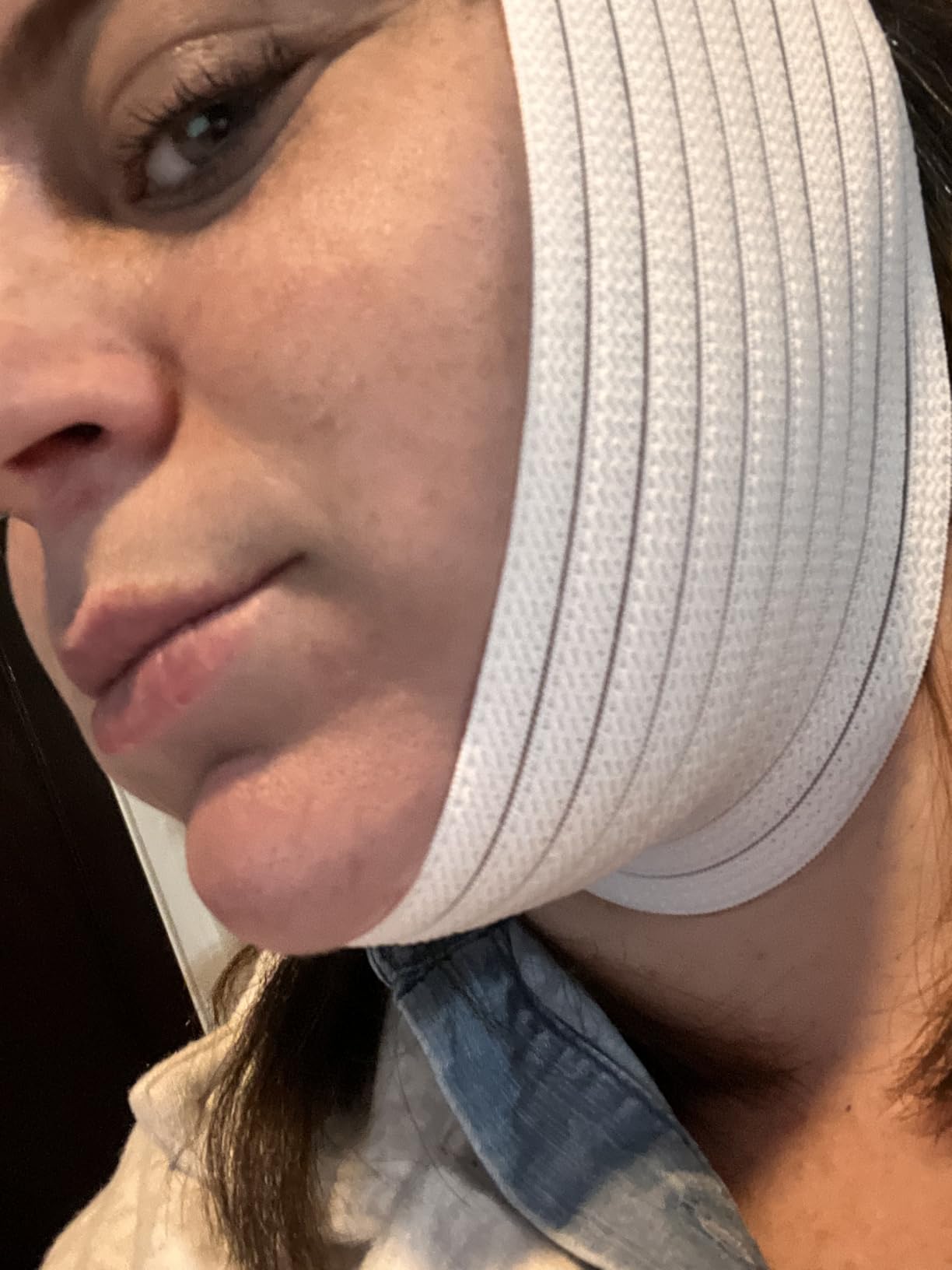 Bistras Super Deluxe White Chin Strap with Extra Support- Anti Snore Chin Strap (2 pk) customer photo 1