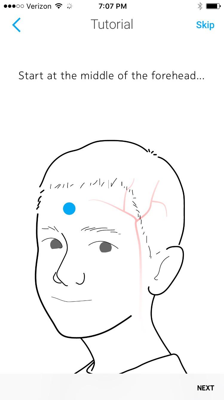 WITHINGS BeamO - Contactless Smart Thermometer, ECG Monitor, Stethoscope customer photo 1